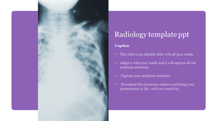 Medical-themed slide featuring an X-ray image and a purple section with placeholder text for radiology content.
