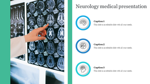 Medical presentation slide featuring a neurologist pointing at brain scans, with space for captions on the right.