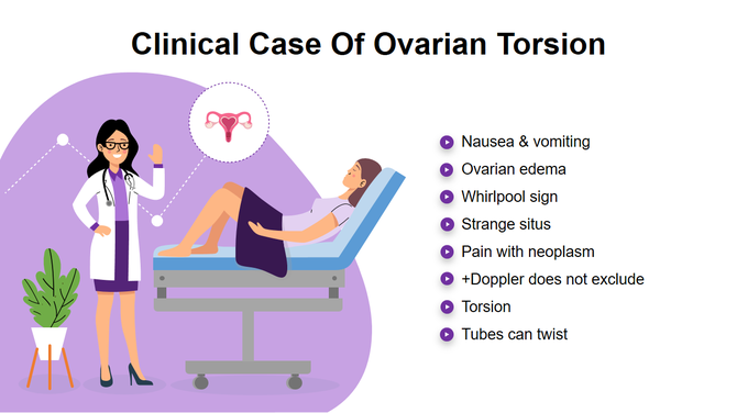 Illustration of a clinical case of ovarian torsion with a patient lying on an exam table and a doctor beside her.