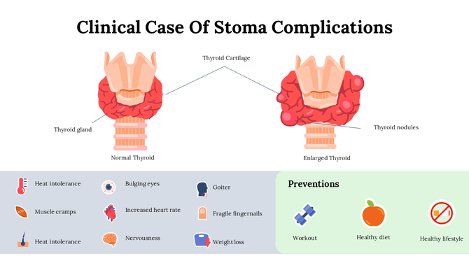 A slide showing normal and enlarged thyroid glands with associated symptoms and prevention tips for stoma complications.