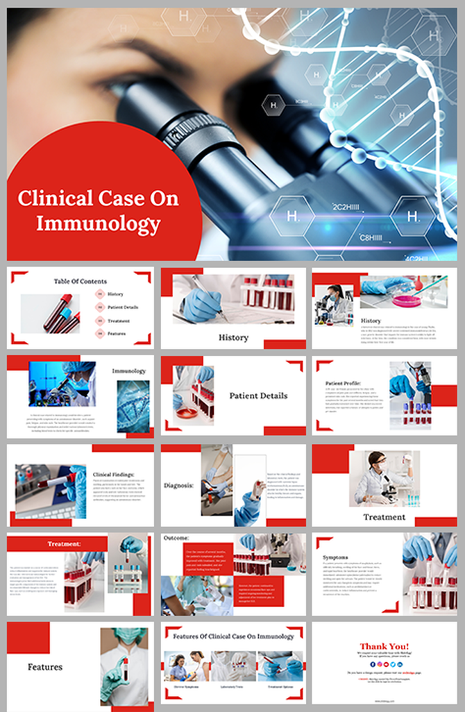 Clinical case presentation slides on Immunology, covering history, patient details, treatment, and clinical findings.