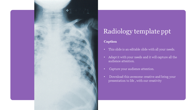Medical-themed slide featuring an X-ray image and a purple section with placeholder text for radiology content.