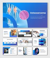 401594-osteosarcoma-01