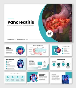 502590-pancreatitis-01